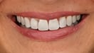 Steal your heart female smile by DemoDanAI on Tensor.Art